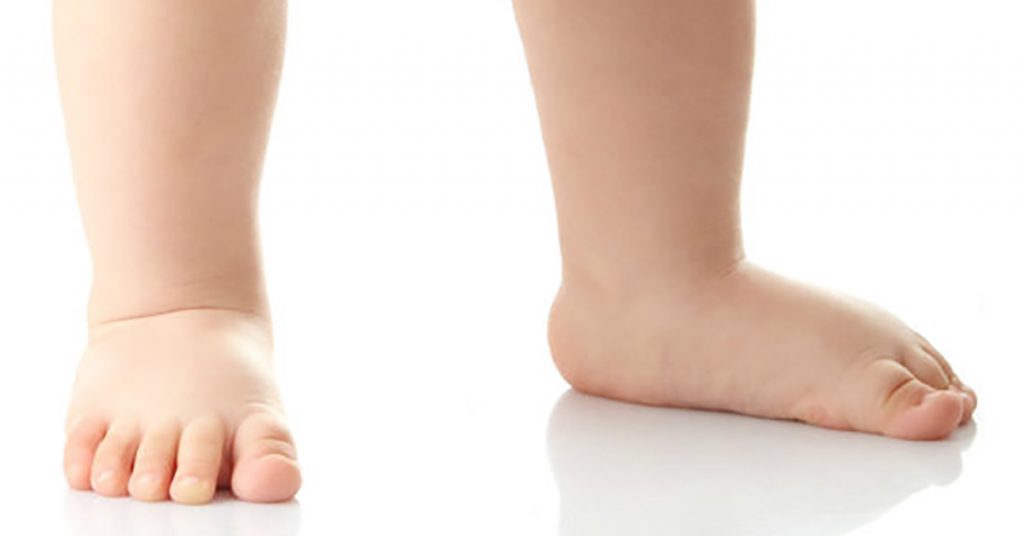 Intervjuu füsioterapeut Liisu Rõigasega:,, See, milliseid jalanõusid lapsed enne 7.eluaastat kannavad, mõjutab olulisel määral jalgade arengut.''